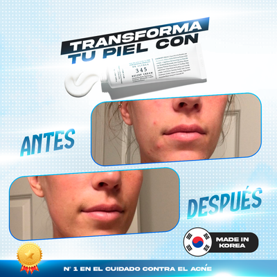 345 Relief Cream® - Alivia, repara y calma la piel irritada.